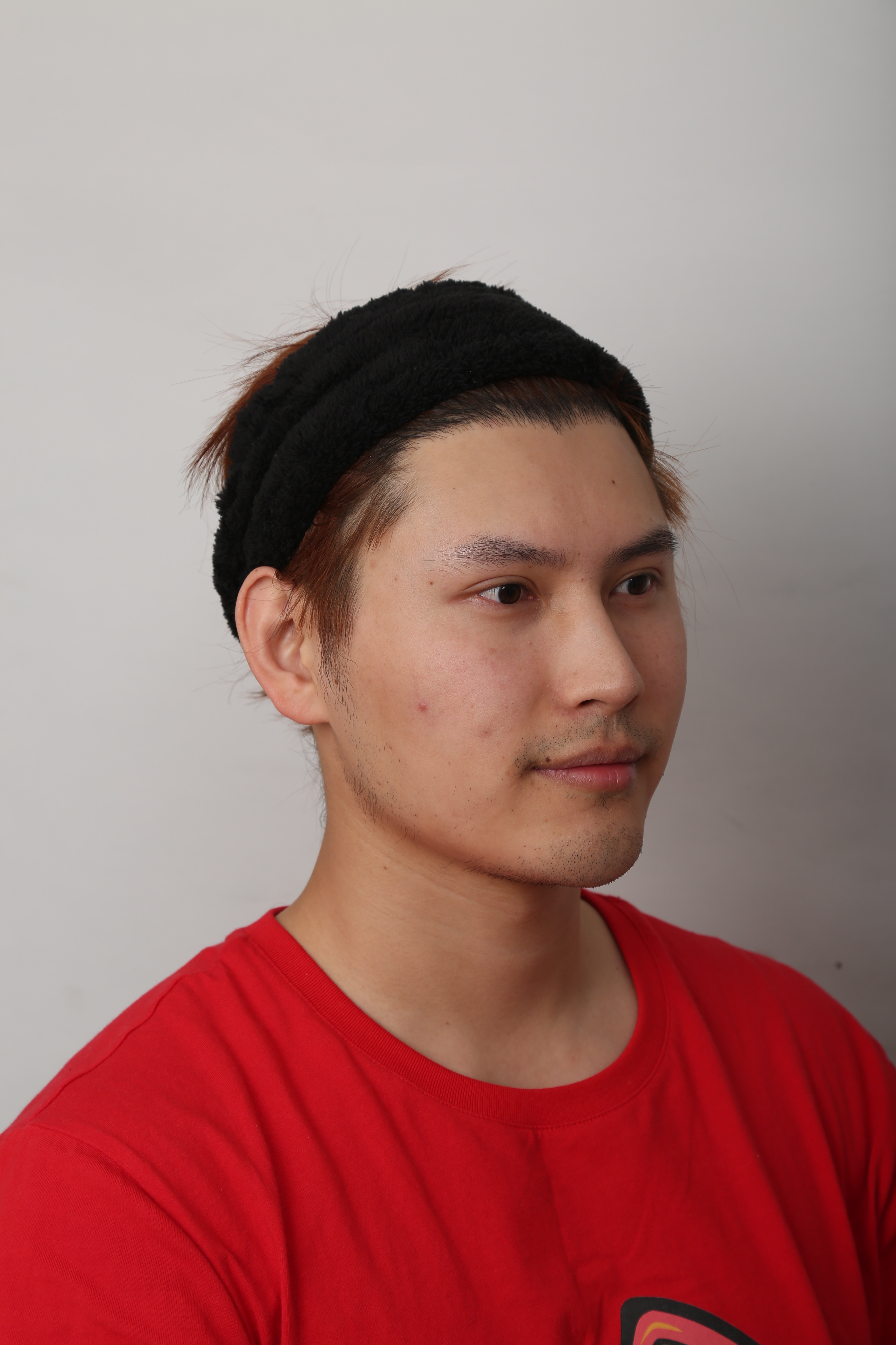 我的鼻子数钱真的很低矮,本身_圈子-新氧美容整形