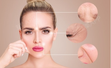 小切口提升术不仅可以改善面部的细纹,而且能一次性解决嘴角的嘟嘟肉