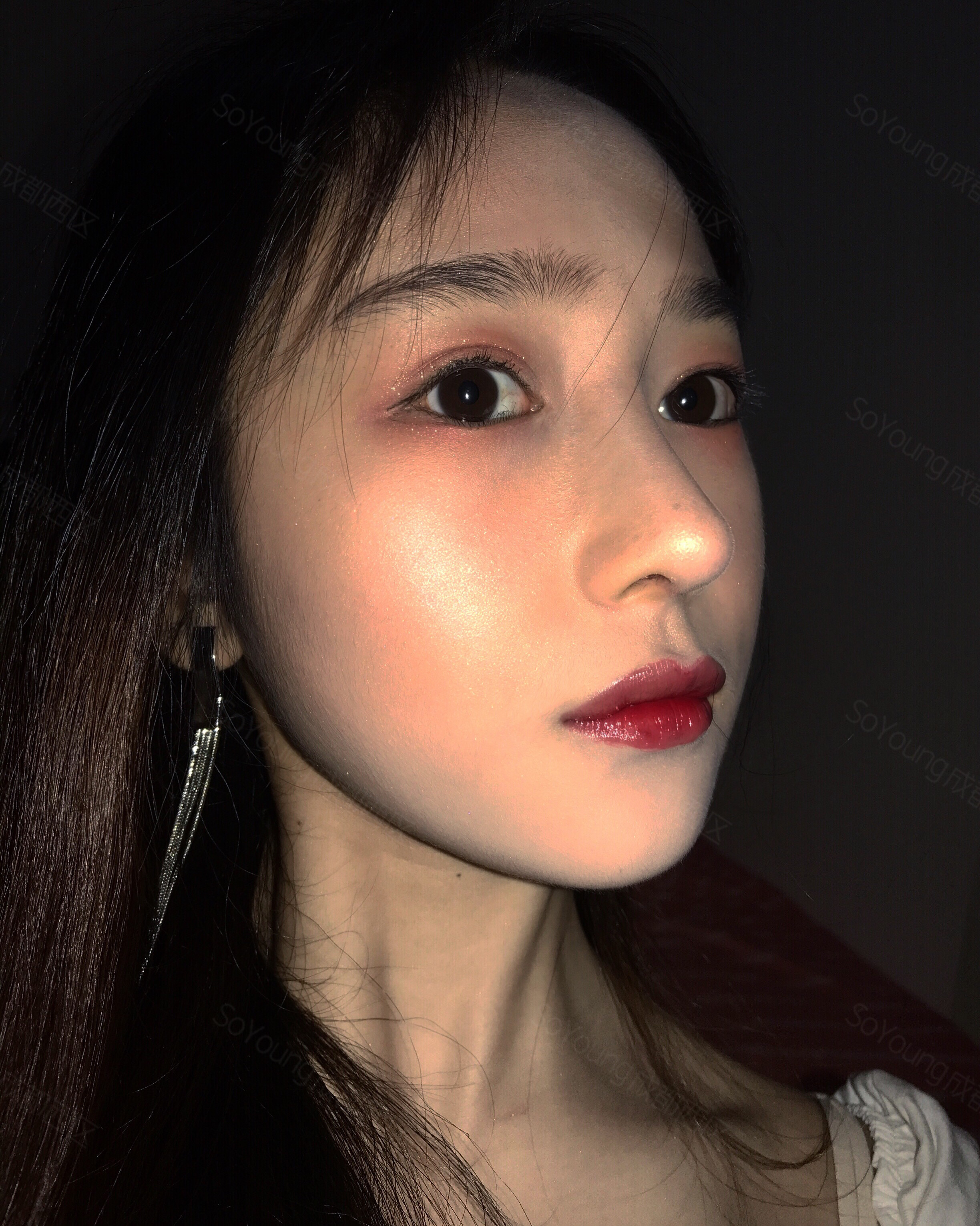 【半肋隆鼻 鼻基底填充136天】终于可以不用永远活_圈子-新氧美容整形