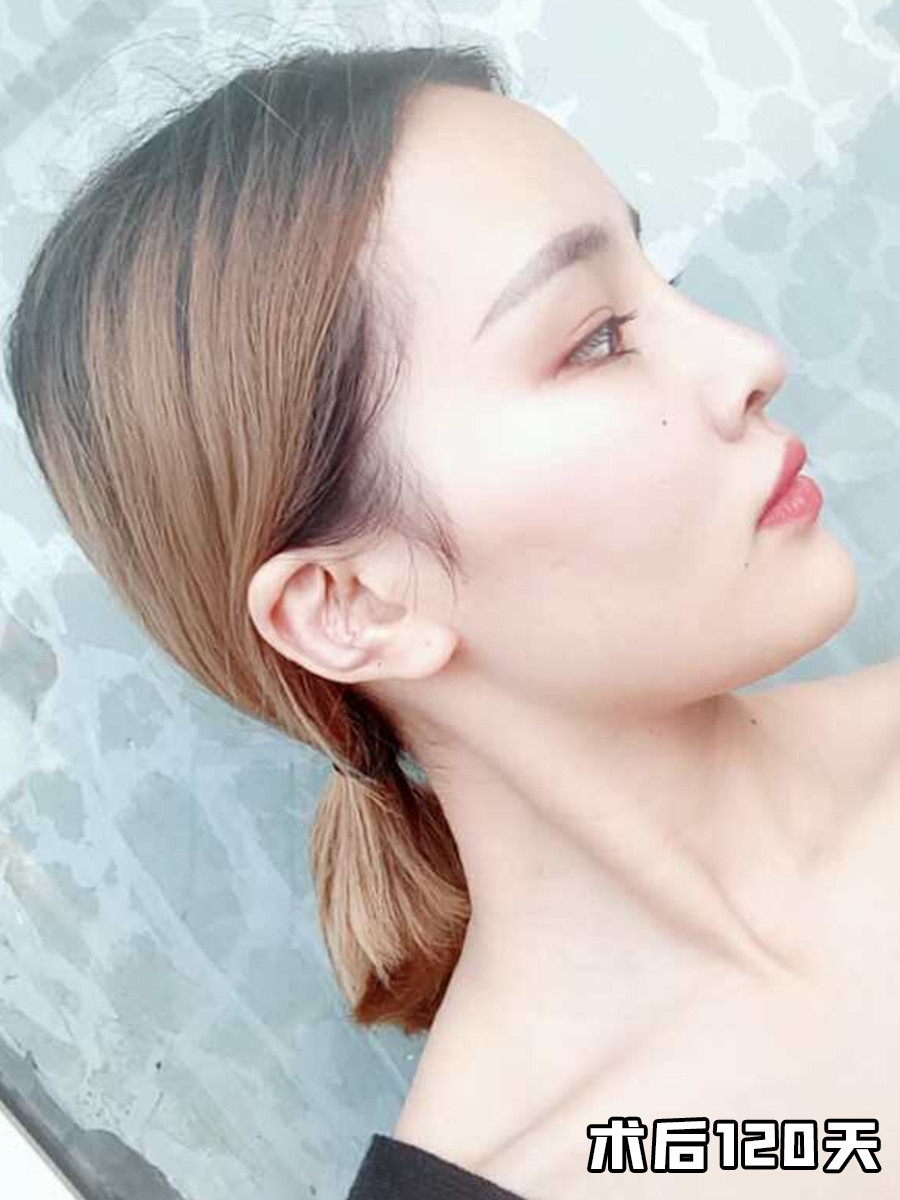 山根起点决定你的风格-鼻整形之山根审美模板