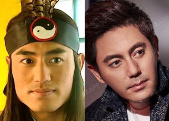 蒙丹你是真的瘦脸成功了吗?