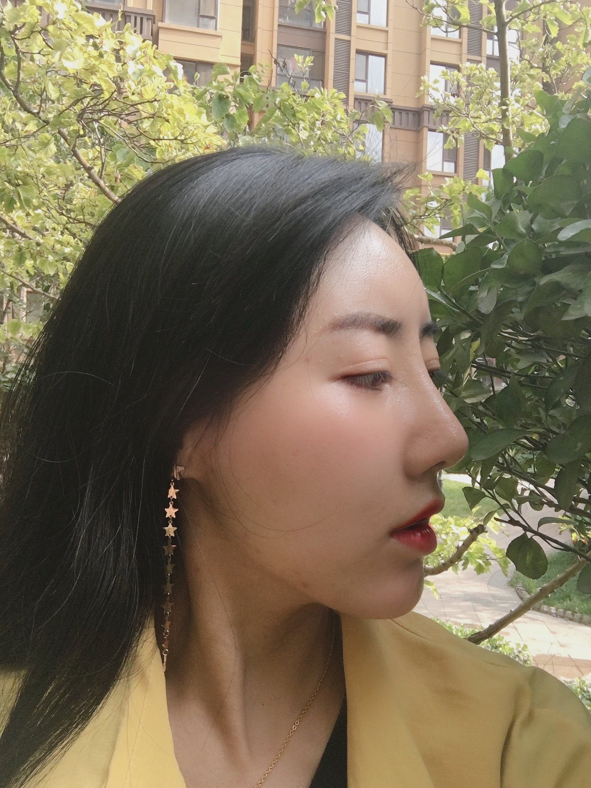 铭医日系轻氧鼻术后131天【吉林铭医整形】99因为自_圈子-新氧美容