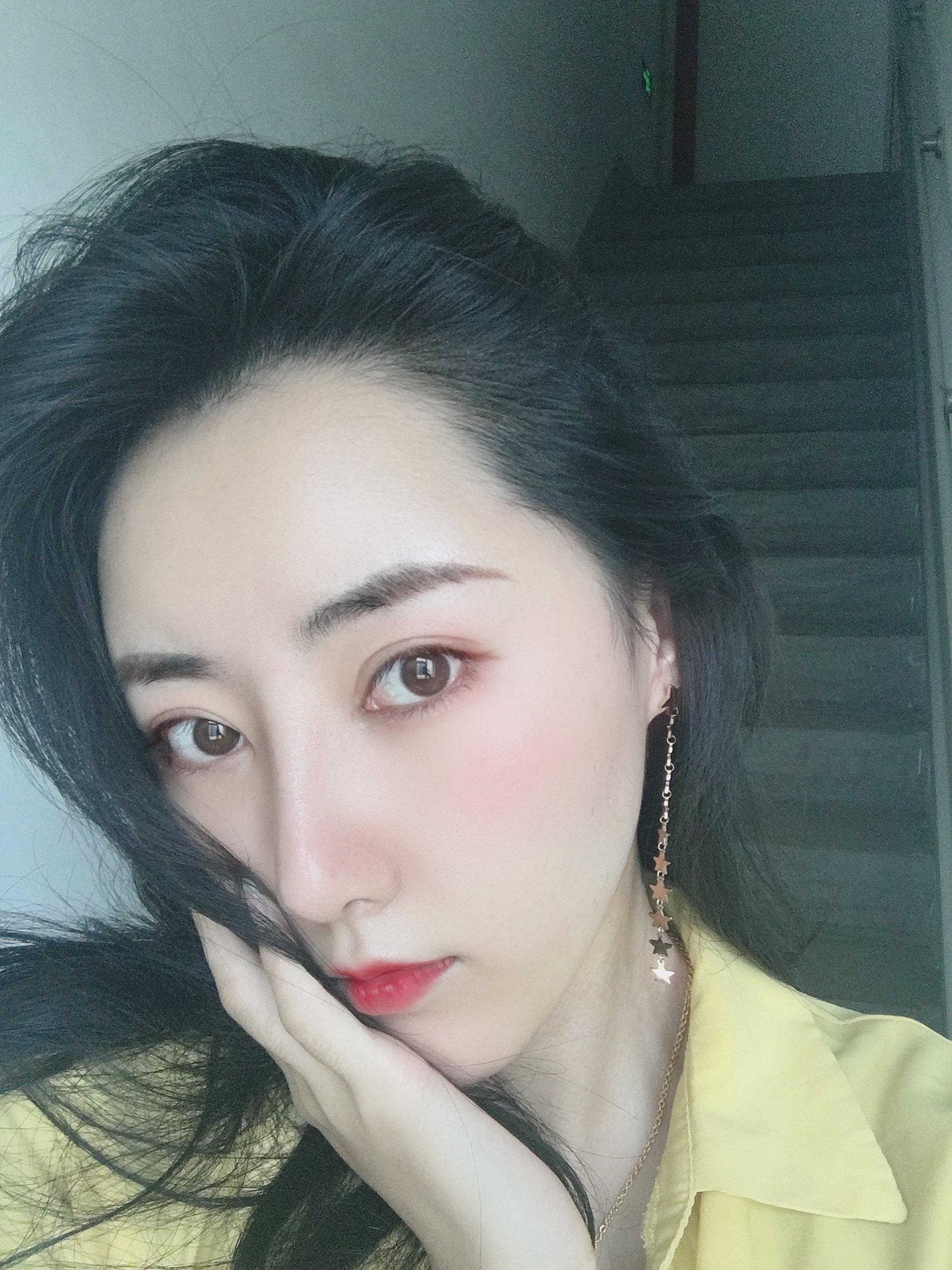 铭医日系轻氧鼻术后 131天