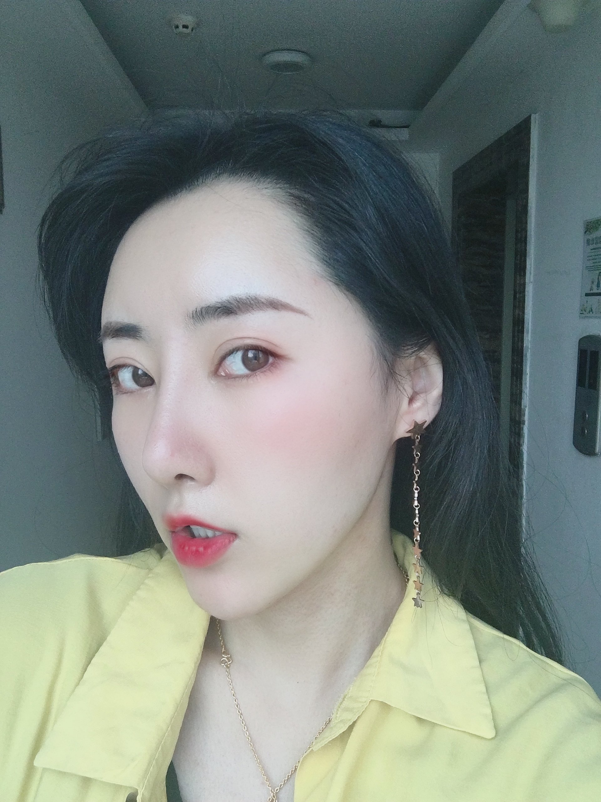 铭医日系轻氧鼻术后 131天