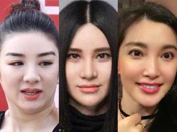 这些明星做错了什么71鼻子会越来越宽71不知从何时开始_圈子-新氧