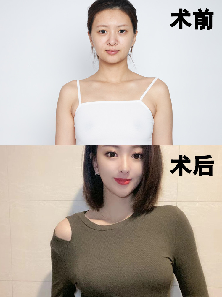 女人乳房脸上图片