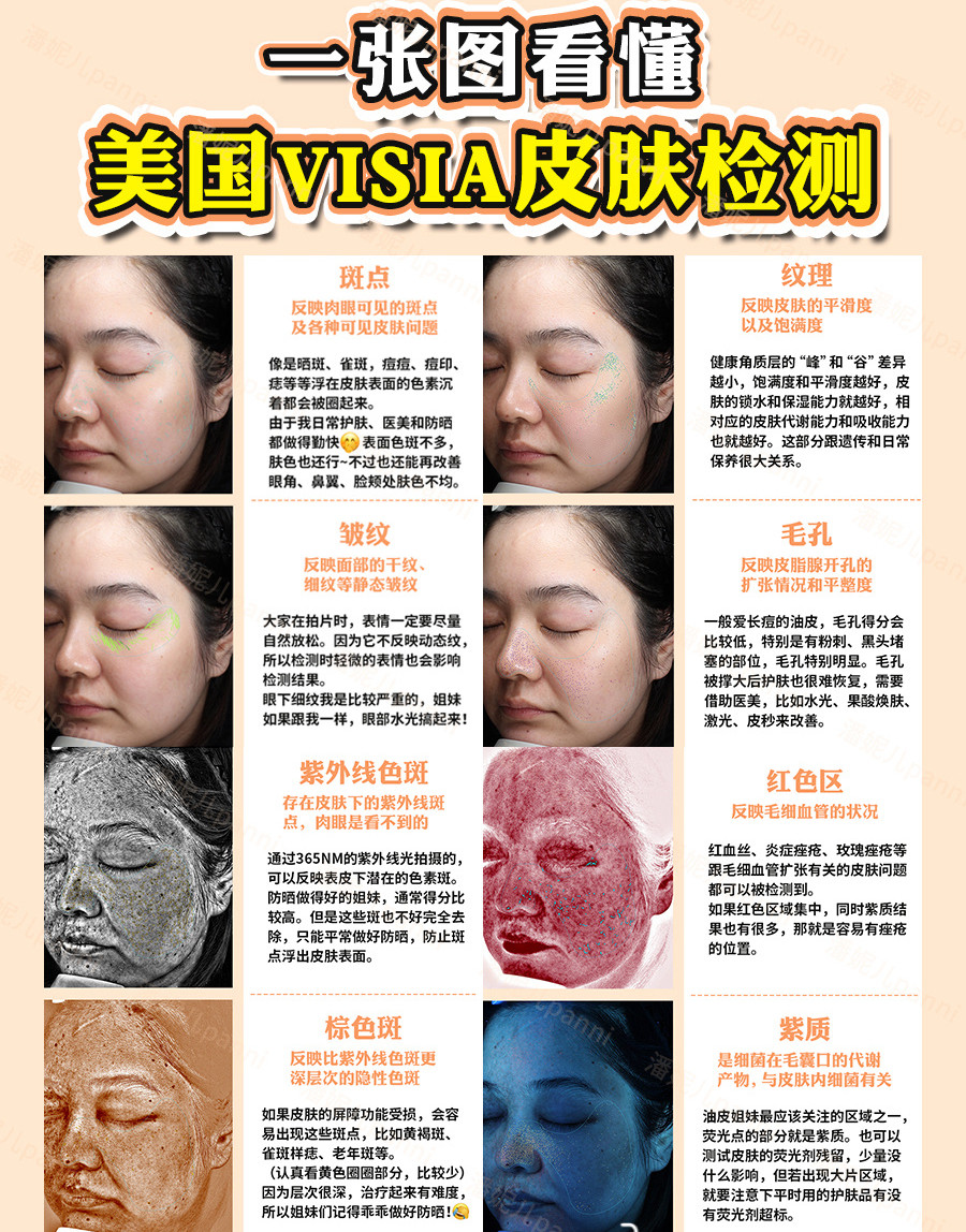 首页 此页面仅支持预览 Avatar 内容官 86篇日记 一张图看懂 Visia皮肤检测报告 纯干货 对着visia检测报告摸不着头脑 无法理解医生的面部问题分析 前方干货预警 看完再也不会被忽悠做没用又贵的项目 Visia是通过超高清摄像头 用