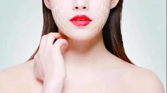 线雕|"大v线"vs"小v线"线雕是面部提升的一种_圈子-新氧美容整形