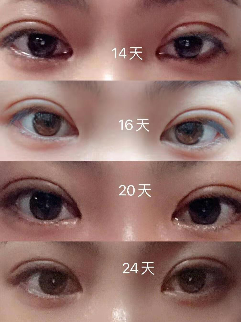 7k的全切双眼皮太好看啦成功上岸