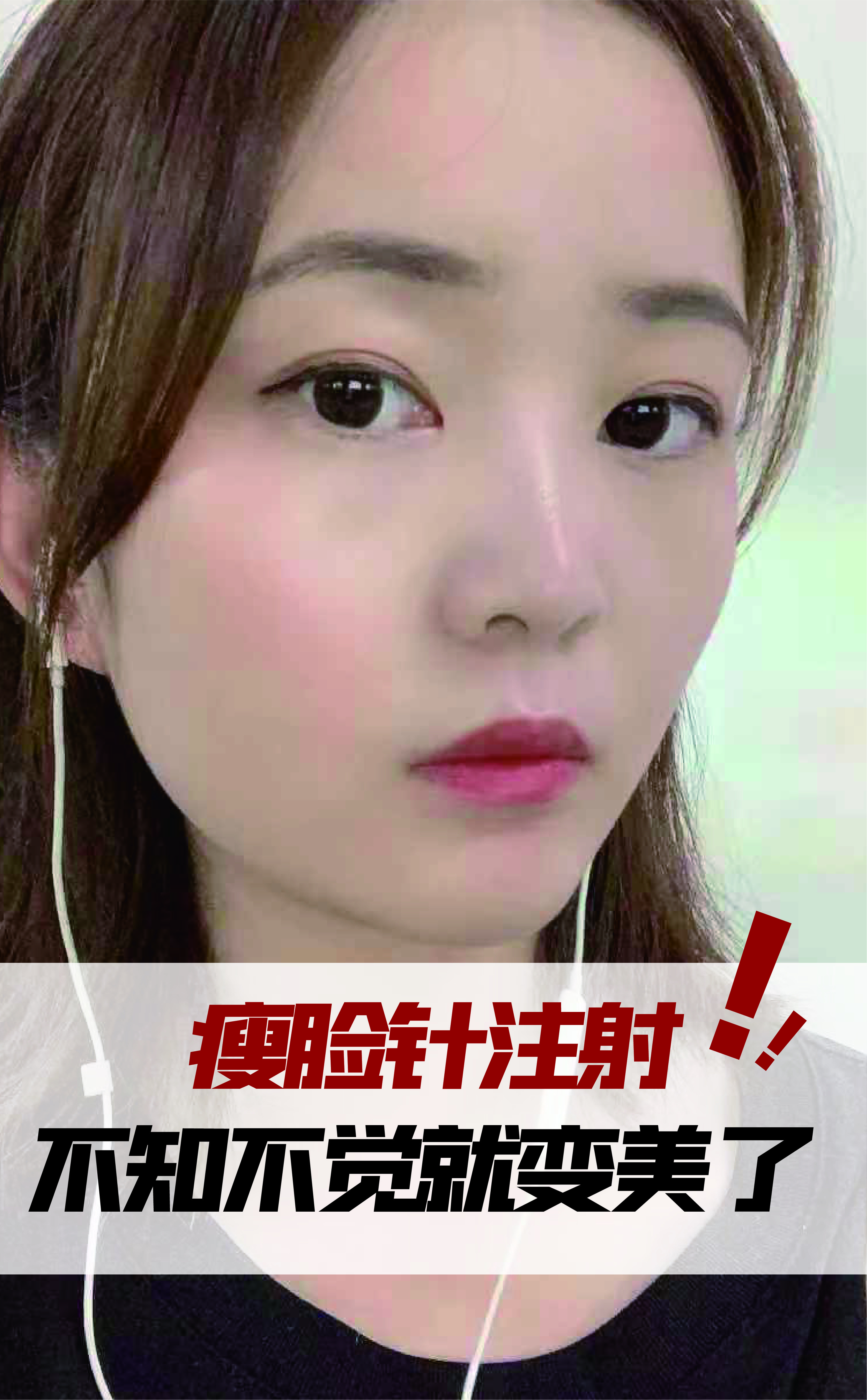 瘦脸针效果对比