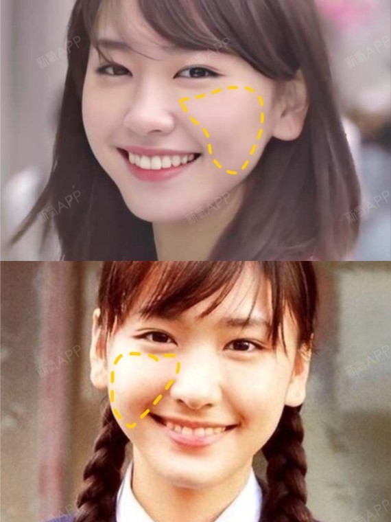 不断层的苹果肌才是少女感的关键75157515苹果肌下垂会_圈子