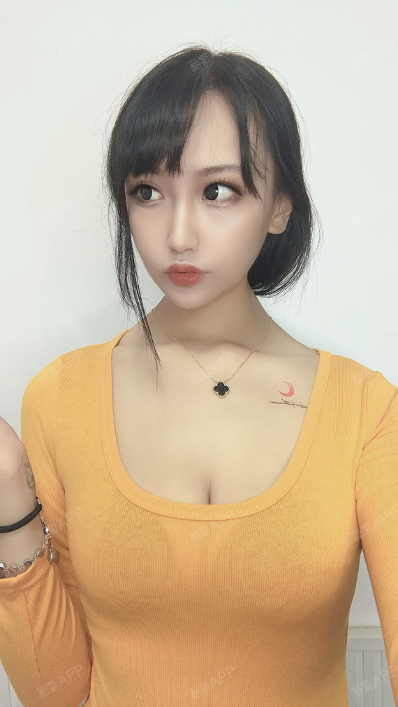 隆胸术后一个月了,我做的是假体隆胸,进口曼托假体 _圈子-新氧美容