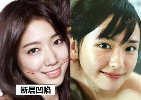 元气甜妹们的苹果肌笑起来时饱满上扬,比如央视第一甜妹和赵露思.