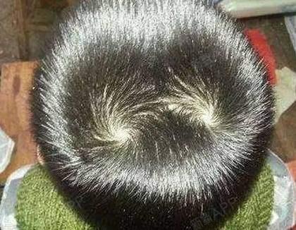 为什么人的头发会有发旋,头旋是怎么来的?