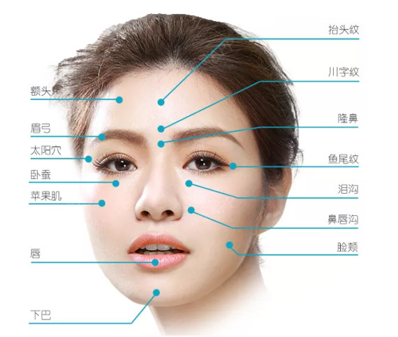 玻尿酸填充部位图图片