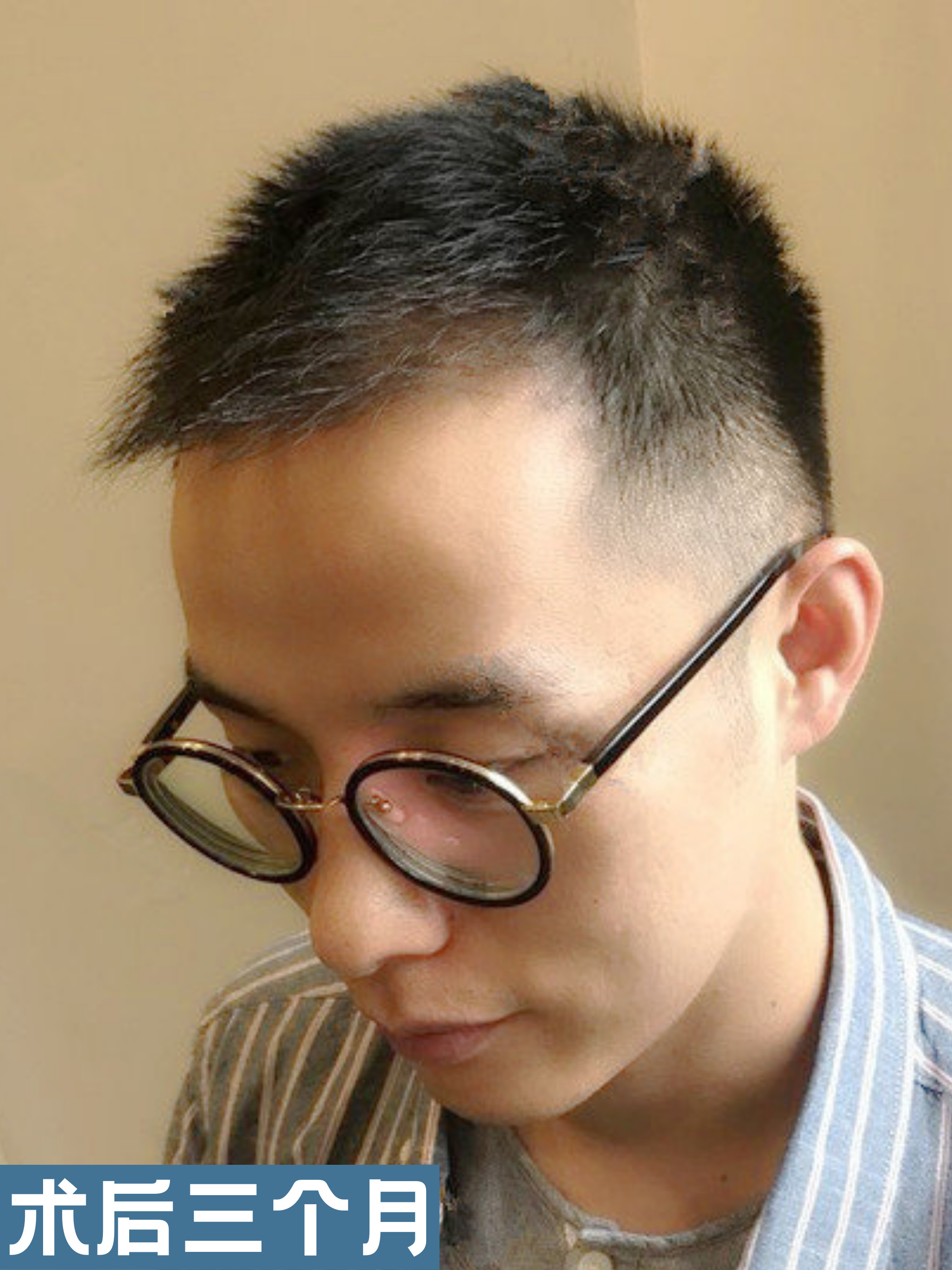 相亲群体植发(相亲发型重要吗)
