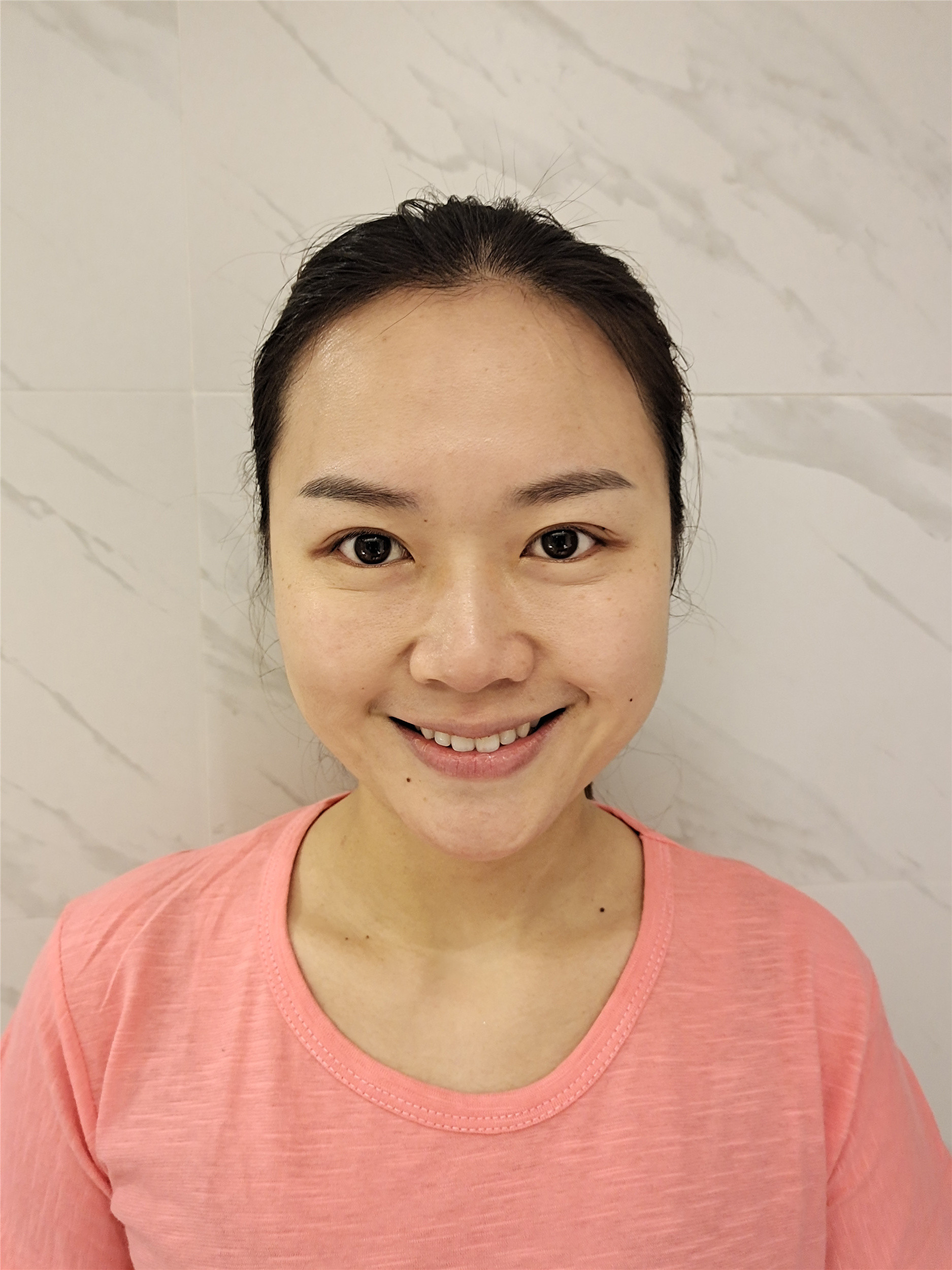 同学里谁有梨涡我就愿意跟他_圈子-新氧美容整形