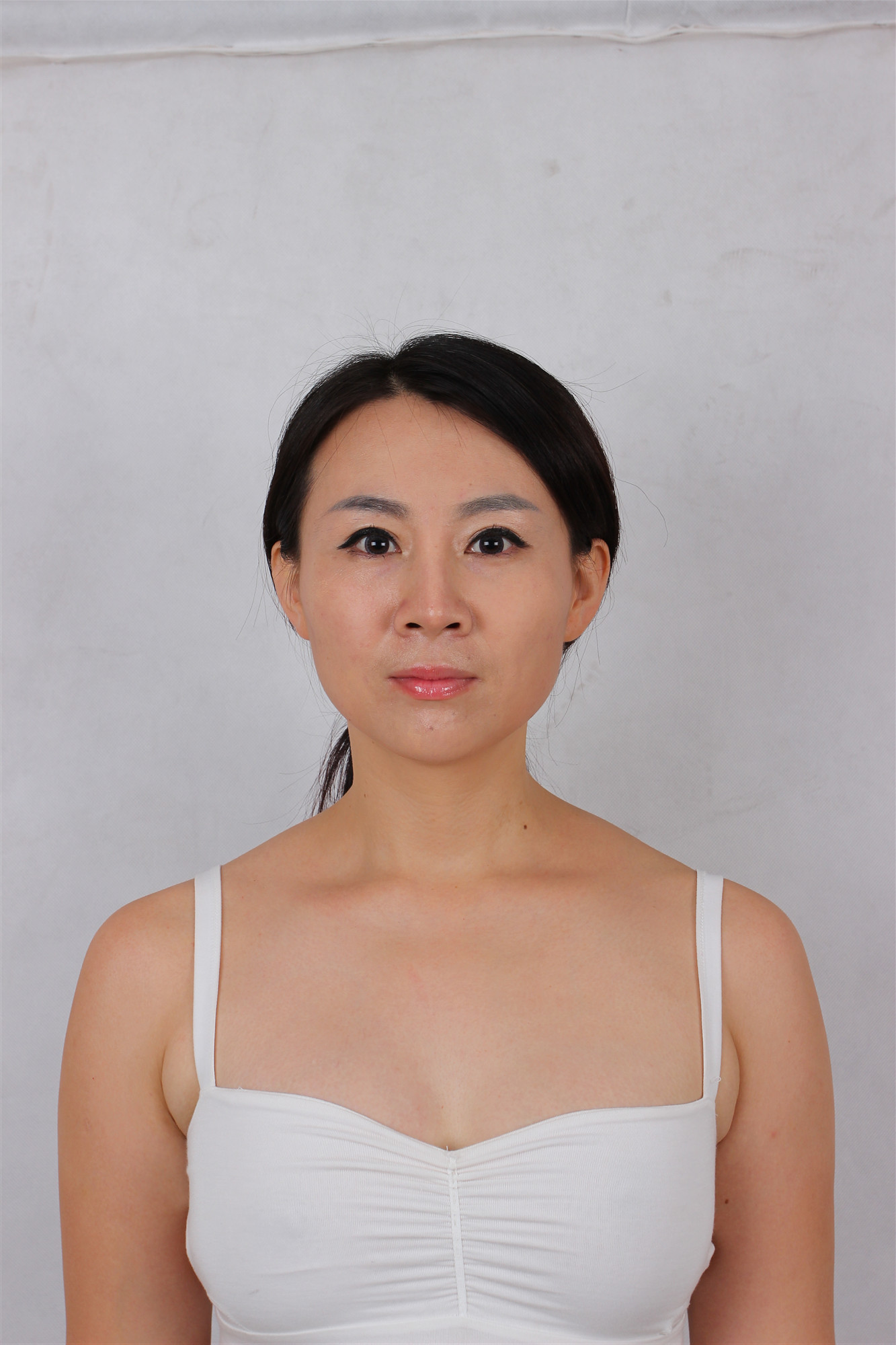 做假体隆胸有一个月啦,上次拍的照片胸还硬看着不自然_圈子-新氧美容