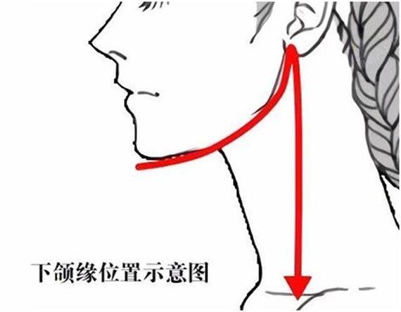 下颌缘提升注射点图图片