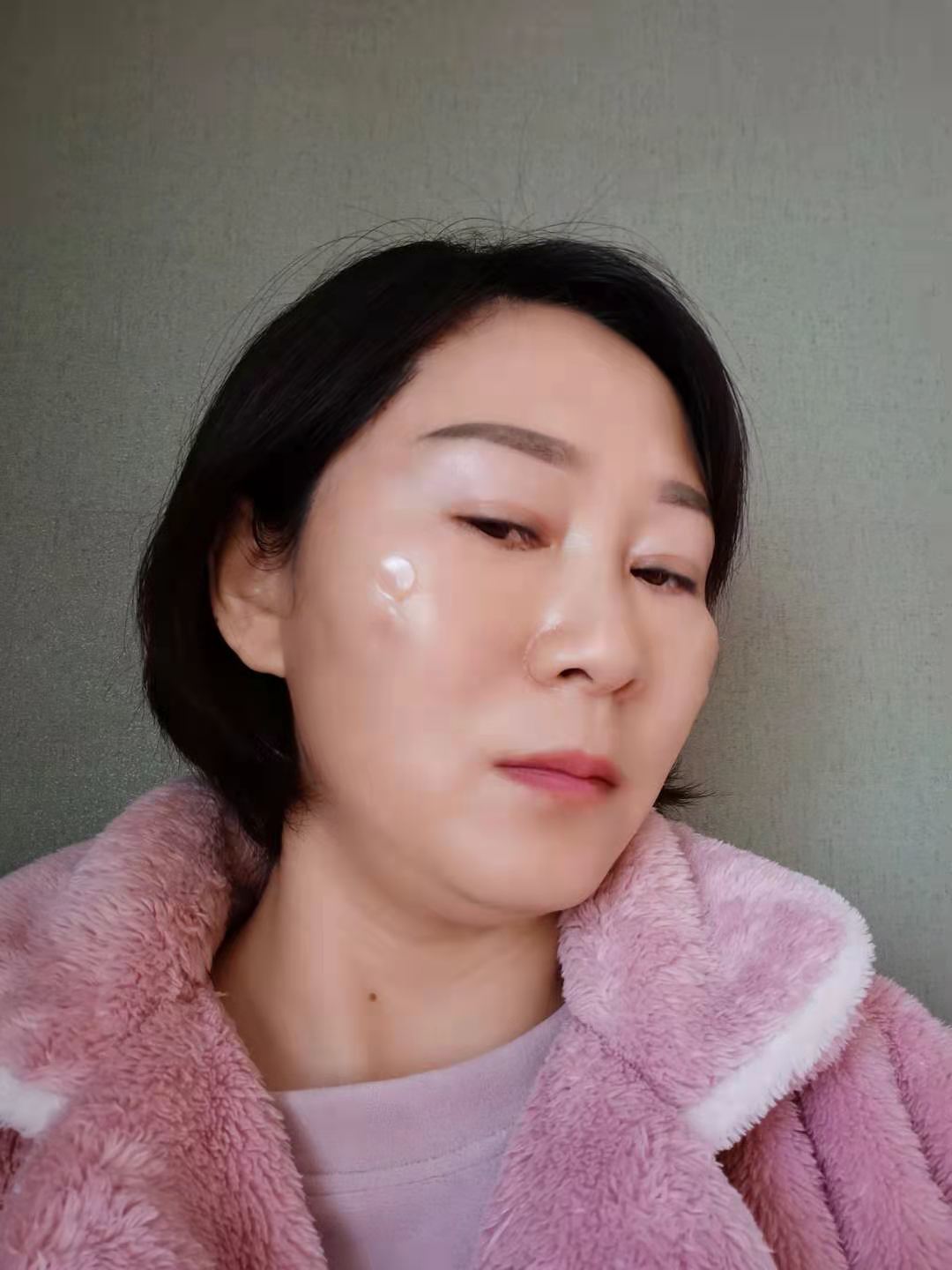 1天今天是做完线雕的第二天,现在肿胀感还是比较明显_圈子-新氧美容