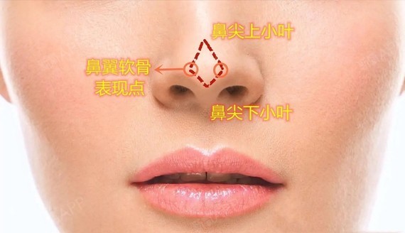 com/p29785466/)我们之前的文章有提到过鼻尖表现点这些鼻部美学的