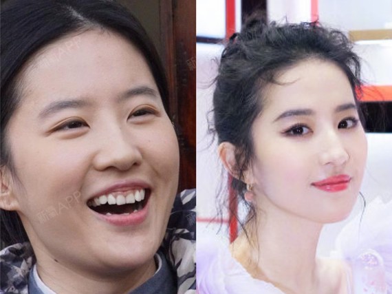 笑起来好看一直都是加_圈子-新氧美容整形