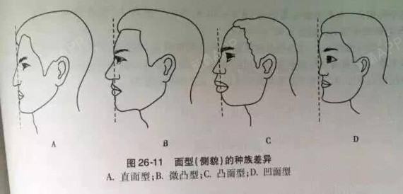 怎么判断鼻基底是否凹陷