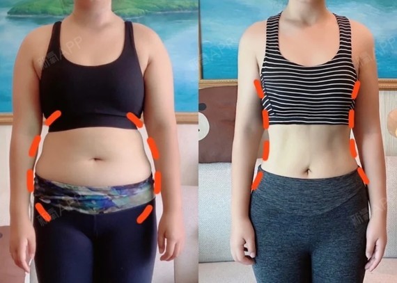 贾玲暴瘦后美到不敢认这瓜子脸也是没谁了