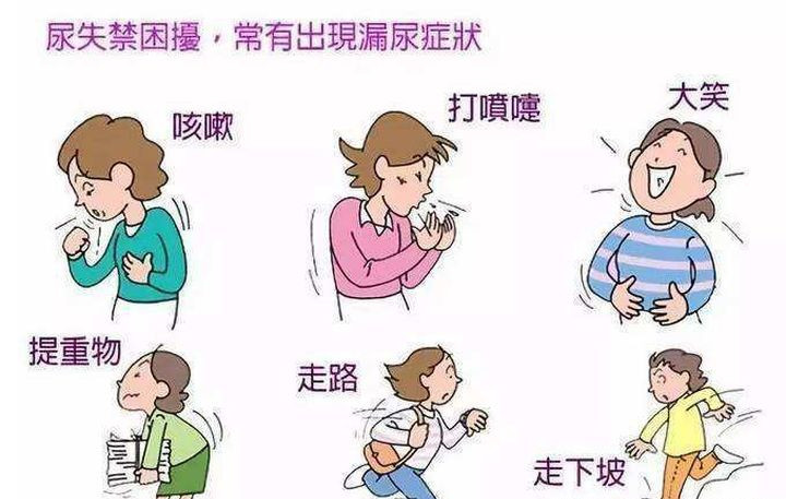 有些人咳嗽,打喷嚏,搬重物,运动,大笑都容易尴尬漏尿.这是为什么呢?