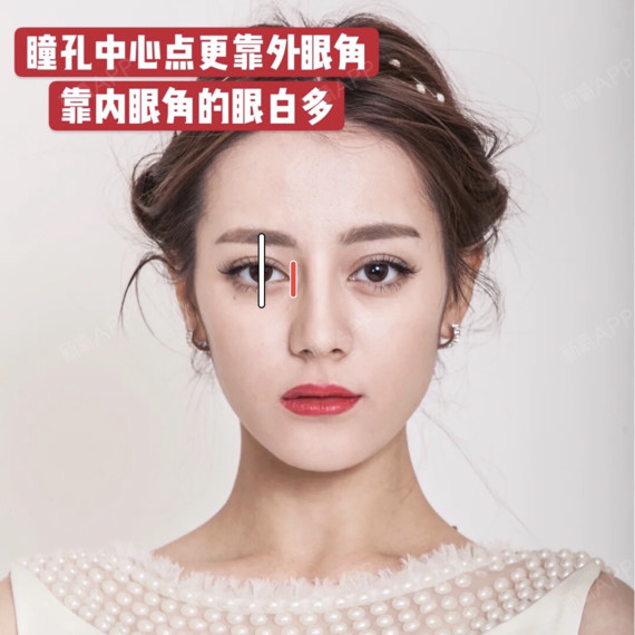 90%的人都不知道,内眼角开不开要看这两个地方6015_圈子-新氧美容