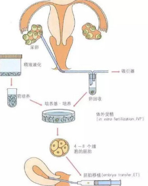 卵巢早衰喝豆漿好得快是真的嗎?