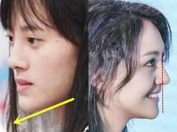 看起来特别高挺,不光是因为鼻梁高,而是因为鼻基底高放大了鼻子的优点