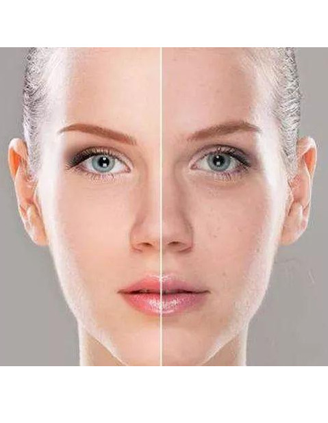 肤色暗沉不均,四个方法教你变水嫩牛奶肌!