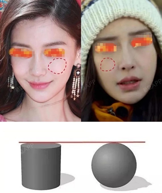 红气下降影响了美貌经典整形模版脸翻车天灾还是人祸