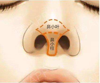 鼻小柱在鼻部整形中的重要性~鼻小柱在哪个部位呢?