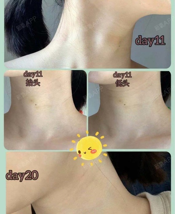 年龄逆袭,从无纹开始天鹅颈,多么美丽的称呼!