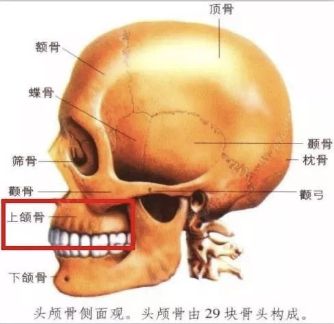 图中标红的部位就是上颌骨:上颌过突或垂直向过度发育,就是传说中的