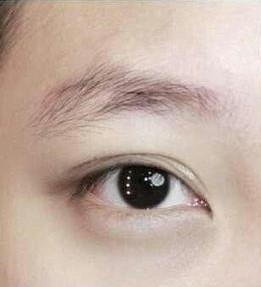 眉毛稀疏缺失眉形不佳眉毛不均匀