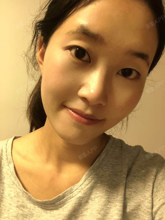 妈生感双眼皮真香