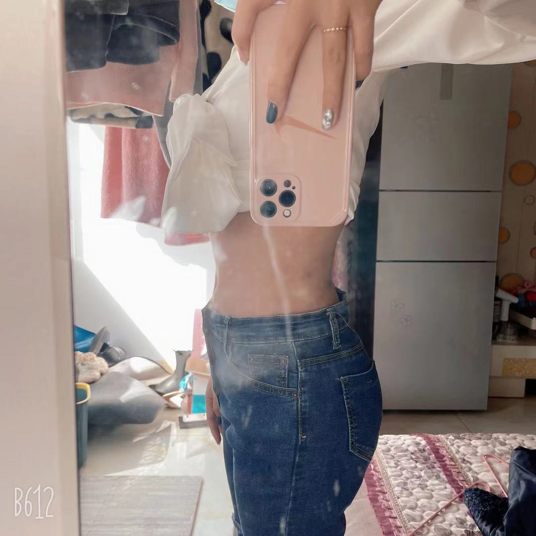 术前诊断:求美者腰腹脂肪堆积,侧面腹部呈前凸装,脂_圈子-新氧美容