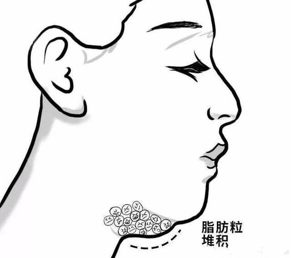 下颌线对颜值的作用