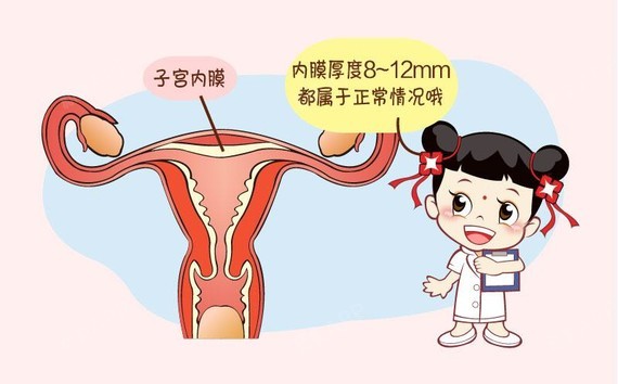 子宫内膜增厚又称子宫内膜增生是指发生于子宫内膜的一组增生性的病变