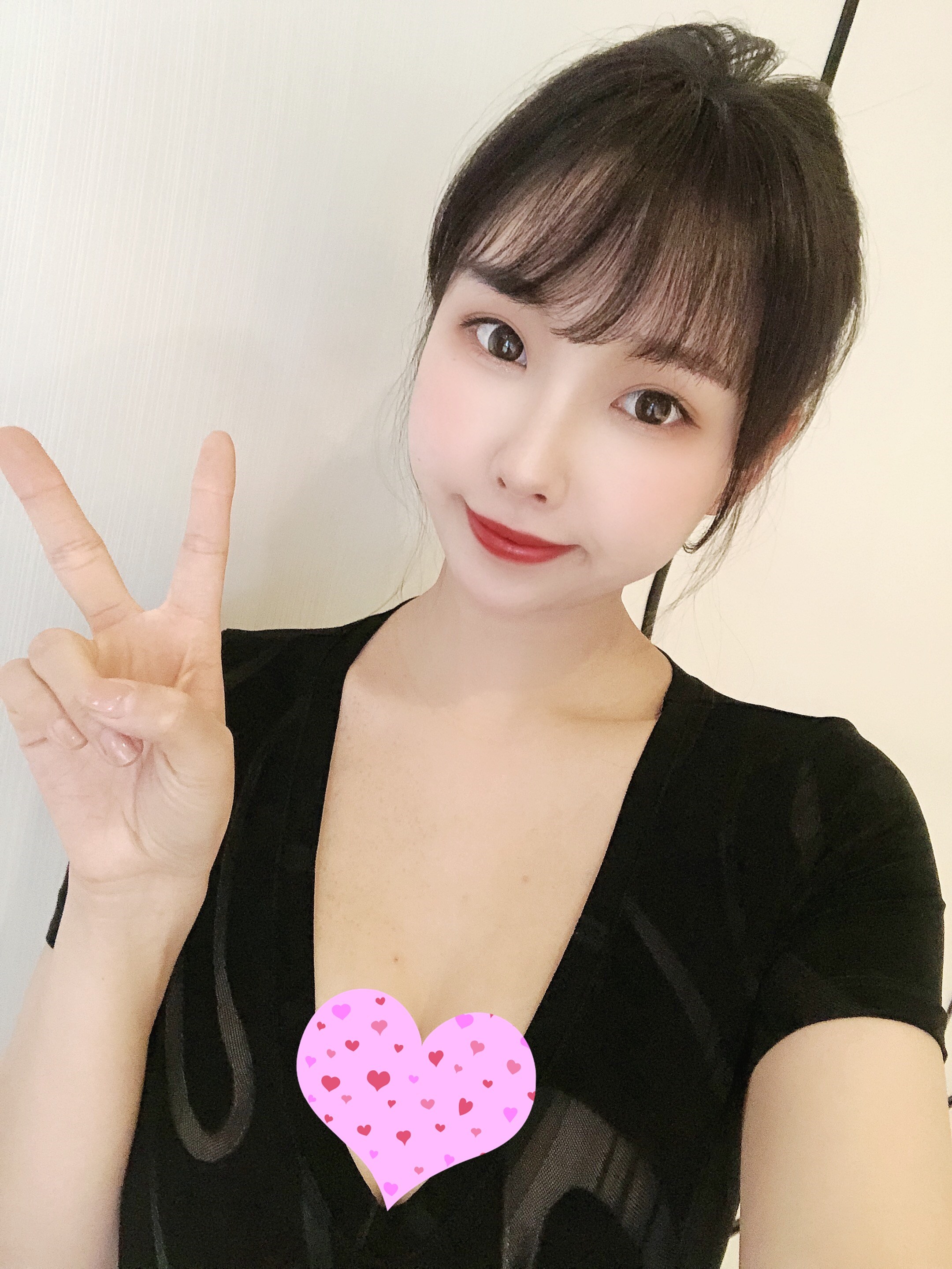 【沈阳美莱—曼托假体隆胸8天】选择做了假体隆胸,做_圈子-新氧美容