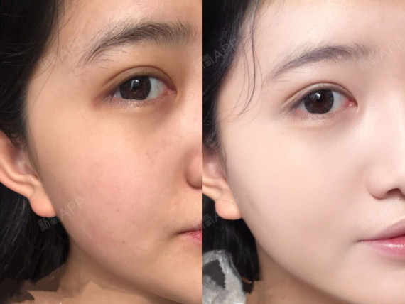 如何实现素颜美肌?