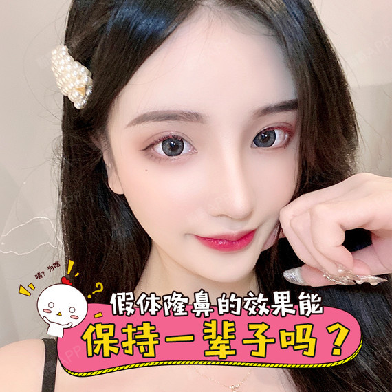 假体隆鼻的效果能保持一辈子吗