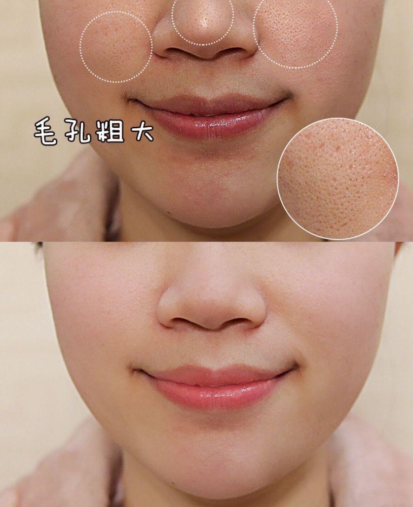 特别是现在高考过了意味着属于学生党的快乐假期来临是一个变美的好