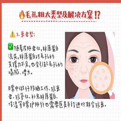 告别毛孔粗大✅实用医美攻略4️⃣类缩毛孔‼️|||_圈子-新氧美容整形