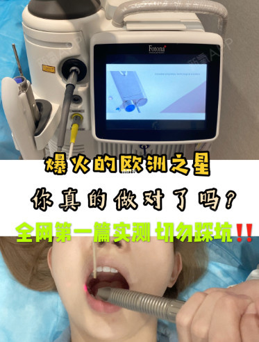 歐洲之星fotona4d跟4dpro的區別效果如何