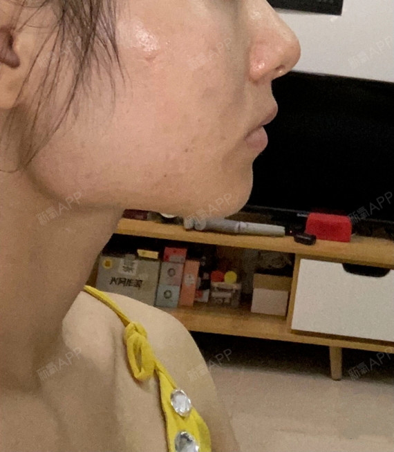 用什么拯救你的下巴