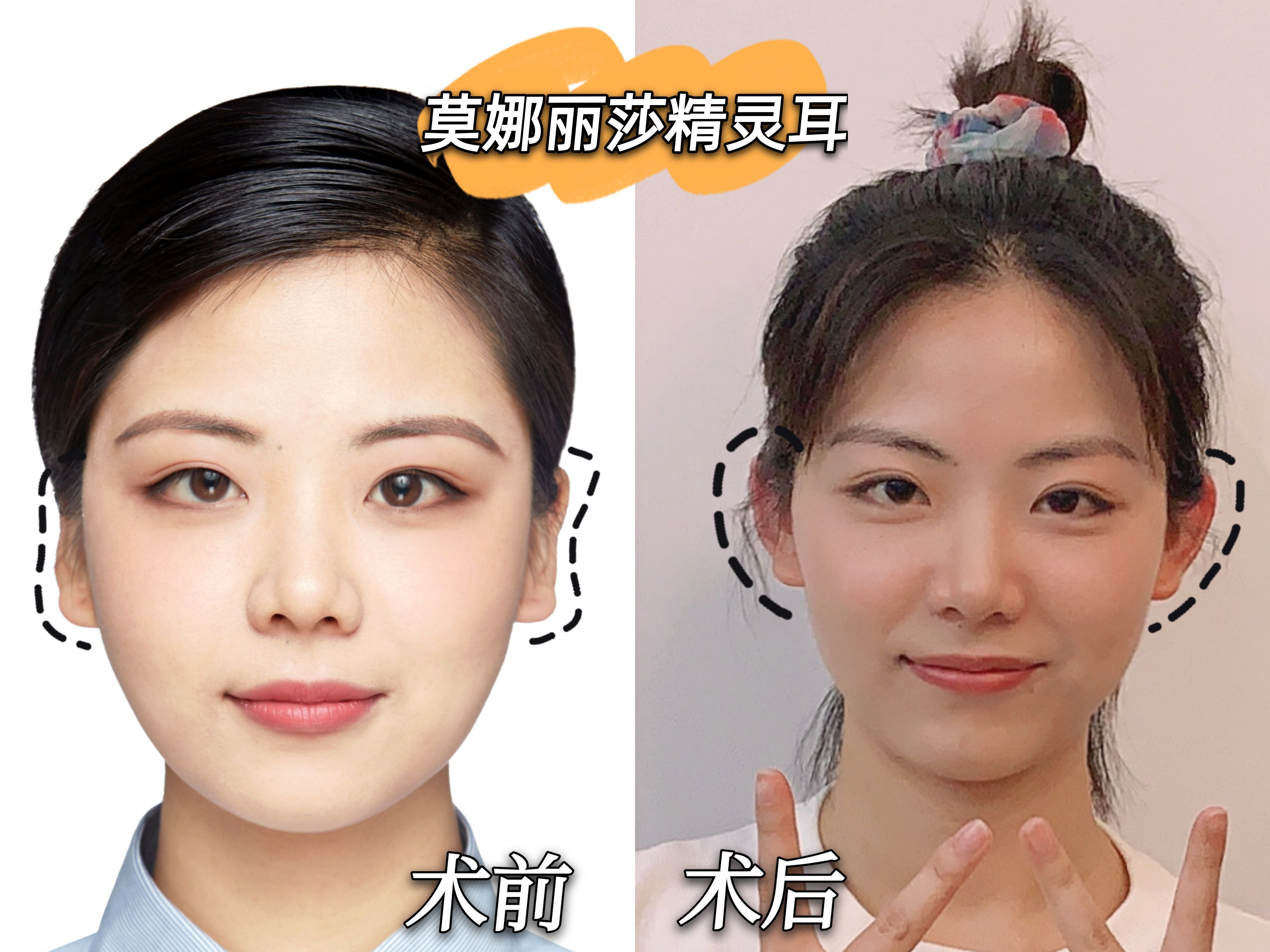 早鸟体验官99location北京艺星莫娜丽莎精灵_圈子-新氧美容整形